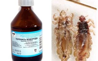 Hydrogen peroxide from lice and nits