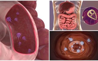 Dove sono i Giardia nel corpo umano