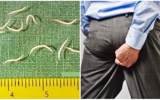 Symptoms and treatment of pinworms in adults