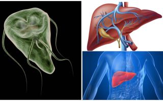 Giardia in the liver - symptoms and treatment