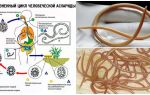 Els símptomes i el tractament de l'ascariasis en adults