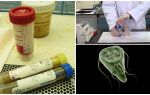 How to properly pass feces on Giardia, methods of analysis