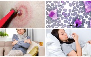 الوحيدات ehrlichiosis في البشر