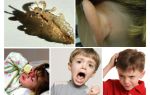 What is dangerous pediculosis