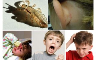 What is dangerous pediculosis