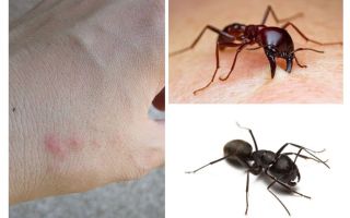 Ant bites