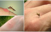 Why mosquitoes bite some people more than others