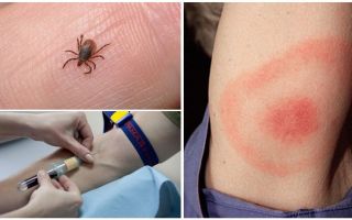 Esame del sangue per la borreliosi