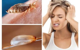 What is pediculosis?