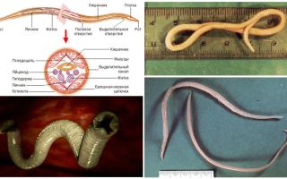 Aspetti Ascaris, caratteristiche della struttura