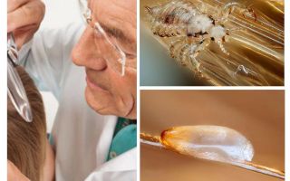 Examination of the patient for pediculosis in the department