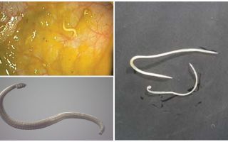 Ways of pinworm infection