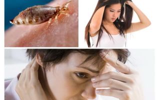 Can lice appear from nerves?