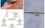 Quanto rapidamente si moltiplicano i pidocchi