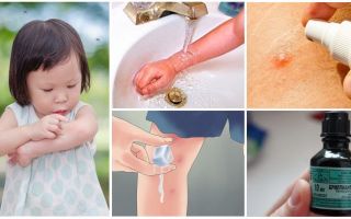 How and what to treat mosquito bites in a child