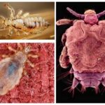 Types of lice