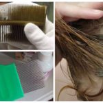 Combing lice and nits