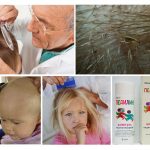 Lice treatment