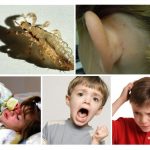 Lice Discomfort