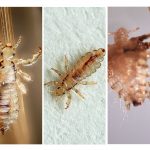 Lice species