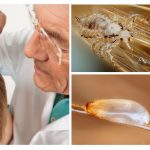 Lice detection