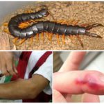 خطر لدغة Scolopendra