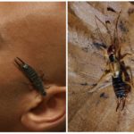 Earwig ในหู