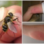 Gadfly Bite