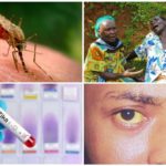 Virus Zika, West Nile e Yellow Fever