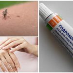 Hydrocortisone ointment for mosquito bites