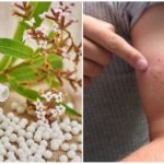 Homöopathische Mittel für eine negative Reaktion auf Mückenstiche