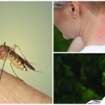 Picades de mosquits