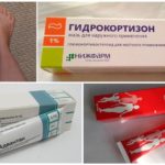 Liječenje edema s hormonskim lijekovima