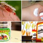 Remeis populars per a picades de mosquits