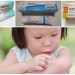 Ointments used in mosquito bites in children