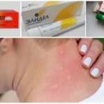 Ungüent de mossegada de mosquits