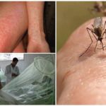 Dengue und Chikungunya Mückenfieber