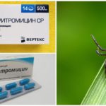 Antibiotici nakon ugriza krpelja