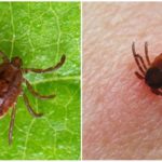 Tick-borne Encephalitis