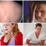 Symptoms of borreliosis