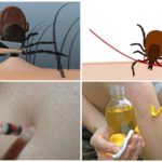 Tick ​​removal methods