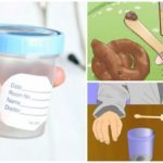 Analysis of feces for roundworm