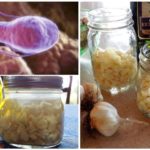 Garlic against giardiasis