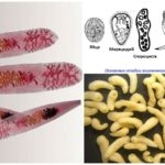 Trematode cycle