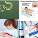 Diagnose von Toxocariasis