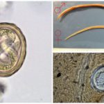 Roundworm e le loro uova