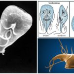 Giardia