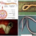 Roundworm structure