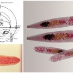 opisthorchis