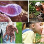 Causes de la infecció per Giardia